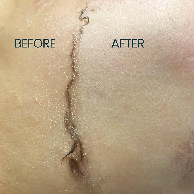 Dermaplane Oil for Women with Normal Skin - Lightweight Face Shaving Oil, Natural Facial Shave Oil, Use with a Dermaplaning Tool, Razor, Shaver or Microblade for Close Shave 4oz by Ouiloe