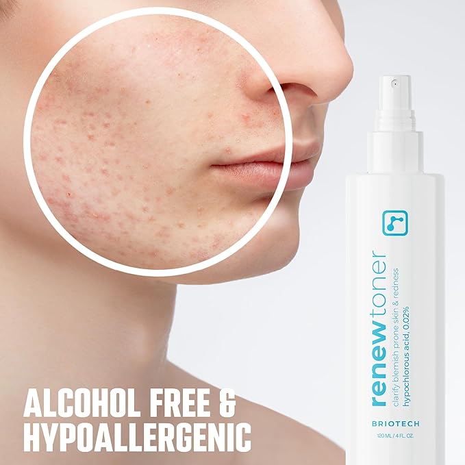 BRIOTECH Skin Renew Toner, Hypochlorous Acid Spray Topical Skin Spray for Face and Skin, Minimize Appearance of Blemishes, Soothing Mist for Redness & Bumps, 4 fl oz ea, 4 ct