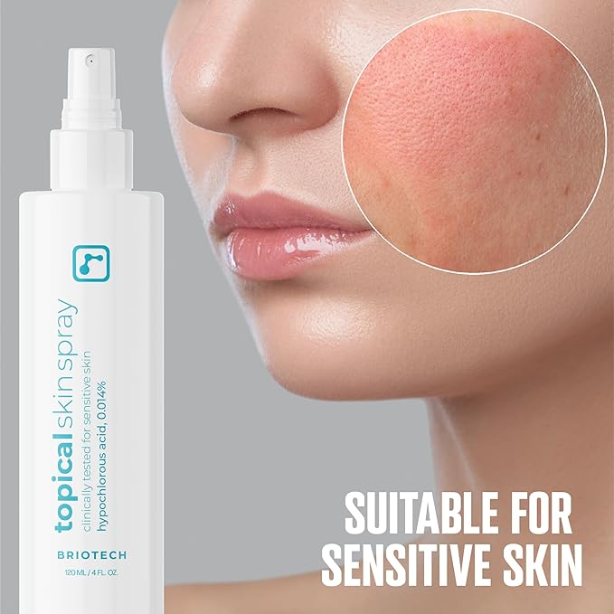 BRIOTECH Topical Skin Spray, Hypochlorous Acid Spray for Sensitive Skin, HOCl Facial Mist, Full Body Support Against Irritation, Calm Redness, Soothe Foot & Scalp, Travel Size 2 oz