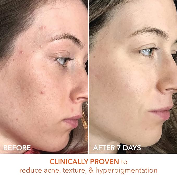 Dr. Dennis Gross Alpha Beta Universal Daily Peel 60 Treatments