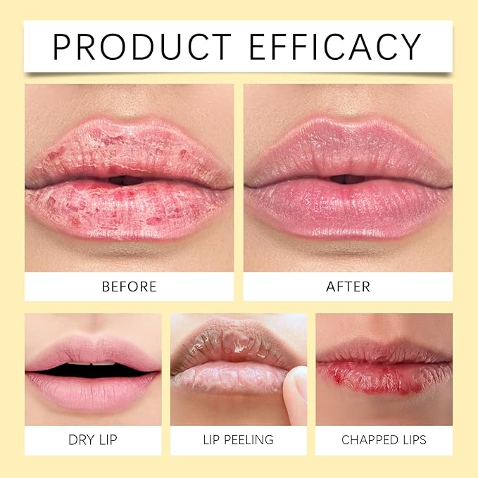 Lemon Lip Balm | All Natural Effortlessly