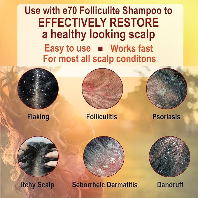 Folliculitis Treatment Hair Conditioner | Moisturize Sensitive Skin, Itchy, Dry Scalp & Damaged Hair Repair | Herbal Extracts for Soft, Shiny Hair | Gentle Color-Safe Detangling Solution