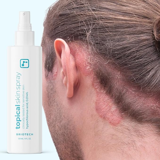 BRIOTECH Topical Skin Spray, Hypochlorous Acid Spray for Sensitive Skin, HOCl Facial Mist, Full Body Support Against Irritation, Calm Redness, Soothe Foot & Scalp, Travel Size 2 oz