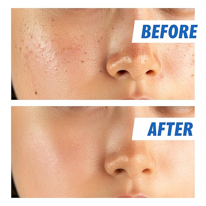 Nightingale Ecto-hyaluronic Ampoule with Hyaluronic Acid, Vegan