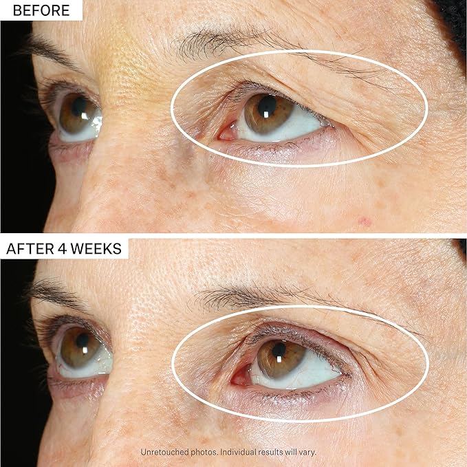 StriVectin Tighten & Lift Peptight 360 Tightening